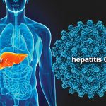 Nuevo aparato será más eficaz para detectar la hepatitis C hepatitis c