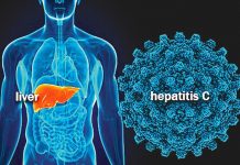 Nuevo aparato será más eficaz para detectar la hepatitis C hepatitis c