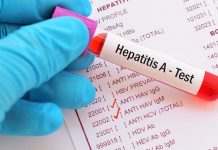 Costa Rica llama a la prevención ante un brote de Hepatitis A costa rica