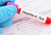 Florida declara emergencia sanitaria por brote de hepatitis estados unidos