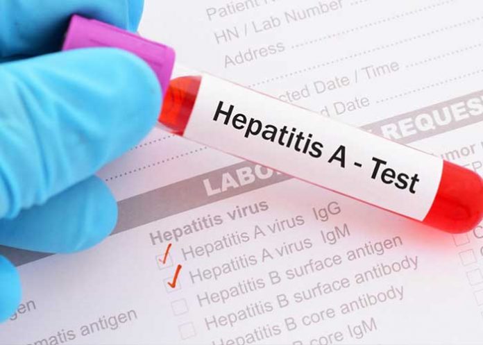 hepatitis-florida estados unidos