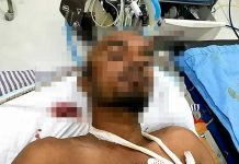 ¡De muerte! Hindú se atraviesa una barra de hierro en la cabeza indu