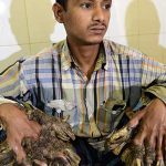 El «hombre árbol» de Bangladés pide que le amputen las manos