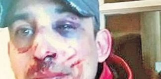 golpes en la cara