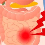 Estos 6 alimentos debes comer si tienes síndrome de intestino irritable sindrome del intestino irritable
