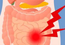 Estos 6 alimentos debes comer si tienes síndrome de intestino irritable sindrome del intestino irritable