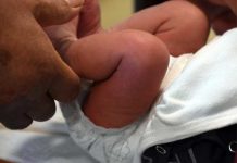 Italia: Bebé de cinco meses muere tras una circuncisión casera