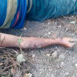 Hombre muere electrocutado cuando realizaba una conexión eléctrica ilegal hombre