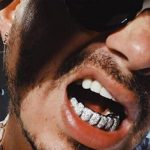 El sufrimiento de J Balvin tratando de quitarse sus dientes falsos estados unidos