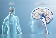 Este examen especial permite diagnosticar tumores cerebrales analisis genomico