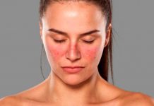 Nuevo medicamento contra el lupus no causará efectos secundarios lupus