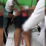 Agreden a machetazos a una mujer en una comunidad de Jinotega nicaragua
