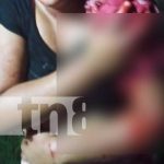nicaragua, machetazos, agresion, mujer, caribe sur,