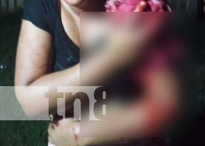 nicaragua, machetazos, agresion, mujer, caribe sur,