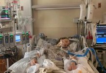 Adolescente queda en coma inducido tras vapear a diario estados unidos