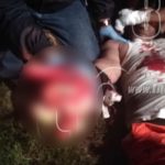 Motociclista lesionado por conductora irresponsable nicaragua