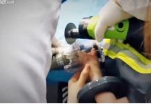 Intenso dolor sufrió un niño al meter su mano en una trituradora