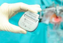 ?Crean «marcapasos cerebral» para mejorar atención en pacientes con alzhéimer