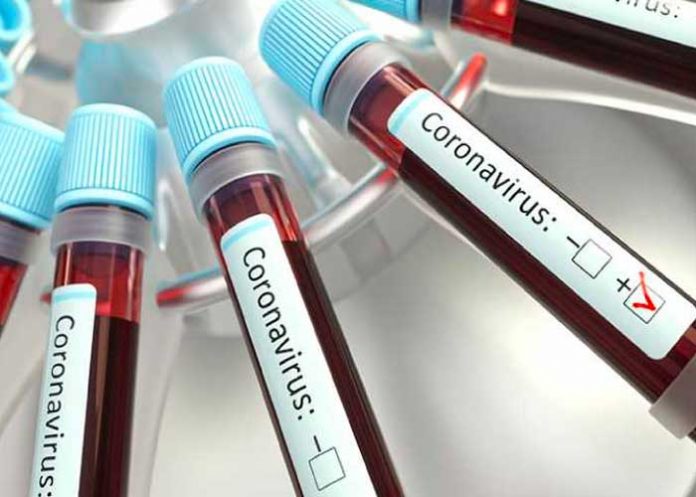 mas-casos-argentina argentina