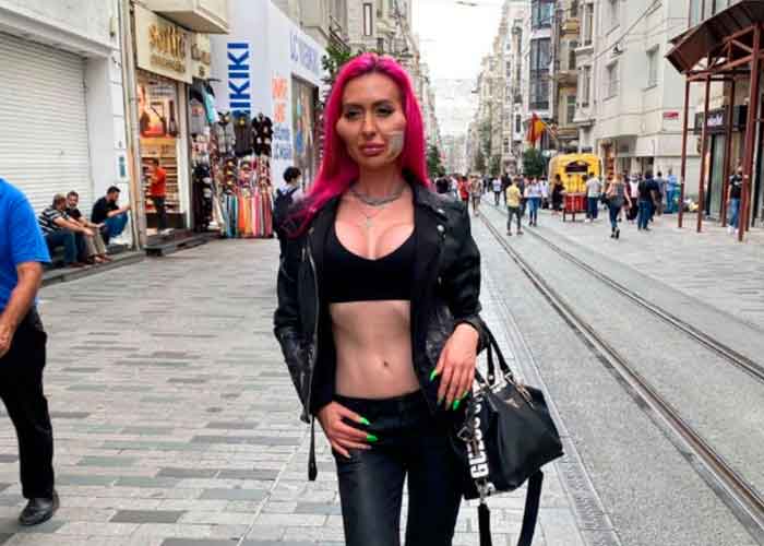 mejillas-mas-grandes-del-mundo anastasia pokreshchuk