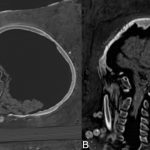Egipto: Descubren momias que conservan organos internos y cerebro ciencia
