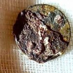 Rusia: Sacan moneda de la nariz de un hombre que se introdujo hace 53 años rusia