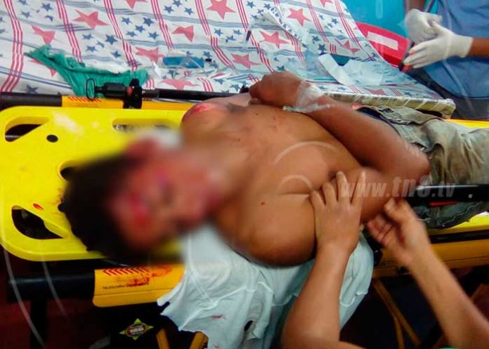 motociclista lesionado