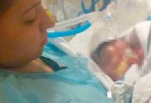 EE.UU: Bebé nace sin piel por una extraña enfermedad estados unidos