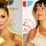 Ninel Conde adicta a las cirugías ¿compite con Alejandra Guzmán? mexico