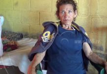 Solicita ayuda ya que padece de enfermedad que no la deja trabajar nicaragua