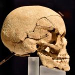 Hallan restos de un guerrero de hace 1.500 años con agujeros en el cráneo cirugia