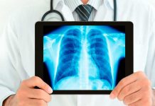 Día Mundial de la Radiología, ¿cuál es el motivo de esta celebración? radiologos