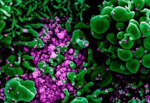 Mirá cómo el coronavirus ataca las células de un hombre contagiado (FOTOS) oms