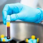 Desarrollan nuevo test que permite detectar más de 50 tipos de cáncer adn