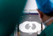 El coronavirus lesiona los pulmones a largo plazo en muchos pacientes pandemia