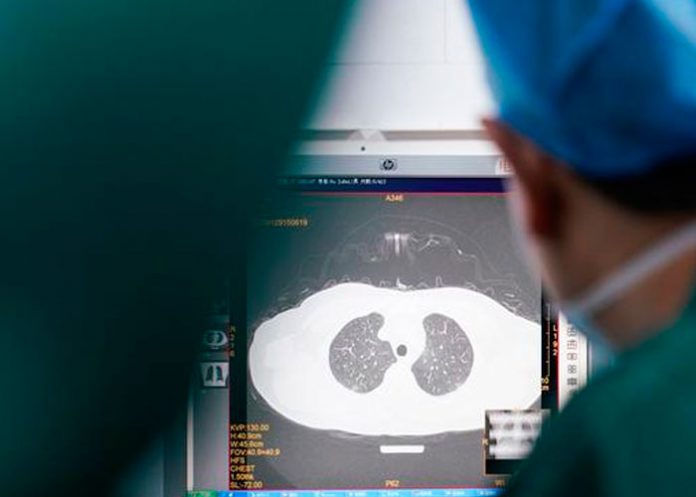 nota-13_KAklQ0C pandemia