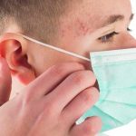 ¿Sabías que el uso de mascarilla puede causar acné? salud
