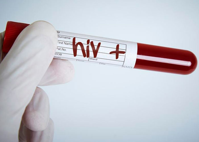 nota-18_SllRoO2 salud