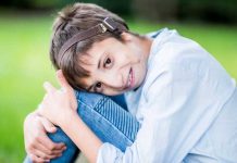 Día Internacional del Síndrome de Treacher Collins enfermedad