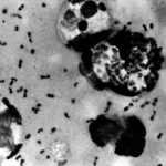 ¿Qué es la peste bubónica? oms