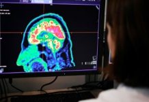 Descubren mecanismo del cerebro para regular la sensación de dolor