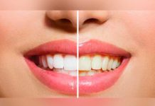¿Qué alimentos manchan tus dientes? esmalte