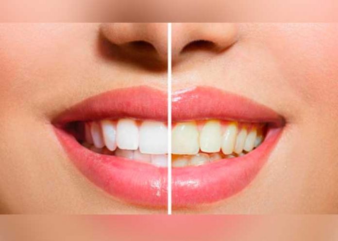 nota-3_k4RbXCQ esmalte