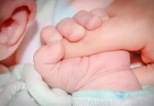 Una niña nace con una segunda boca producto de una rara condición