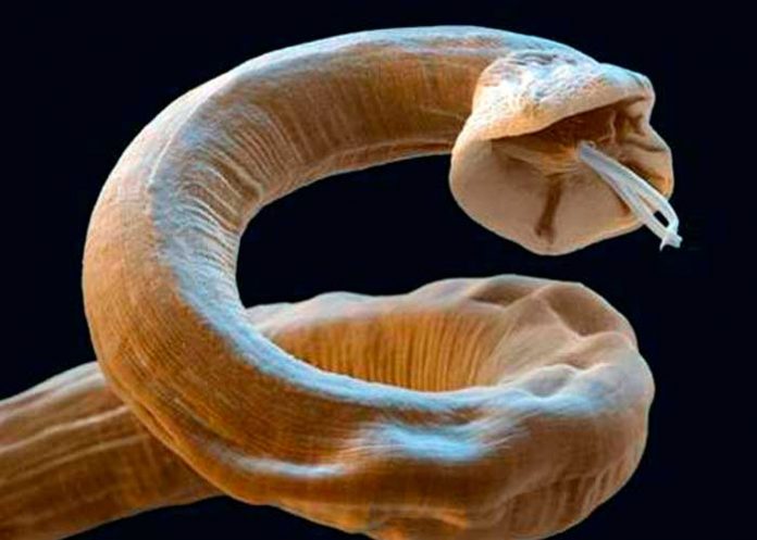 nota-4.3_WrkLWZ1 diarrea