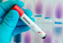 Desarrollan nuevo tratamiento para lograr una vacuna contra la malaria vacunas preliminares