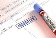 Segundo caso mundial de curación de un paciente con VIH virus
