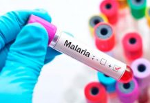 El riesgo de contraer malaria aumenta en las primeras horas de la noche sintomas