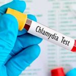 Clamidia: Una infección de transmisión sexual silenciosa epidemias silenciosa