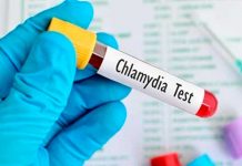Clamidia: Una infección de transmisión sexual silenciosa epidemias silenciosa